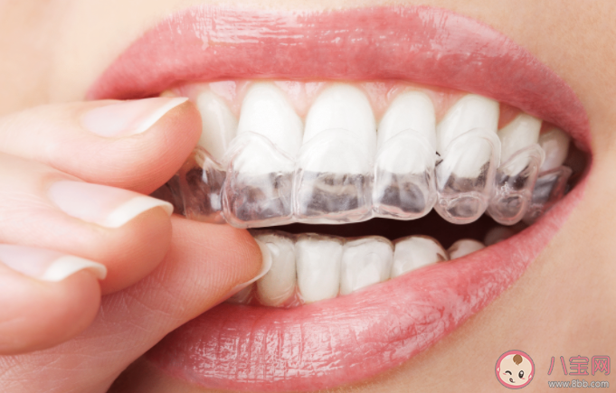 美白牙贴存在哪些安全隐患 美白牙贴是如何让牙齿变白的