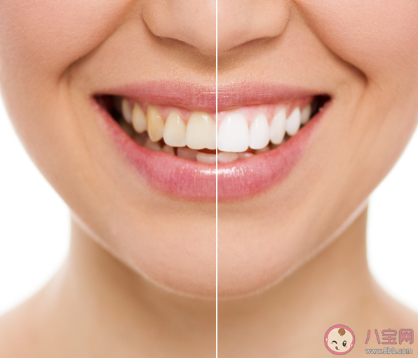 为什么长期刷牙牙齿还很黄 关于牙齿黄的错误理解